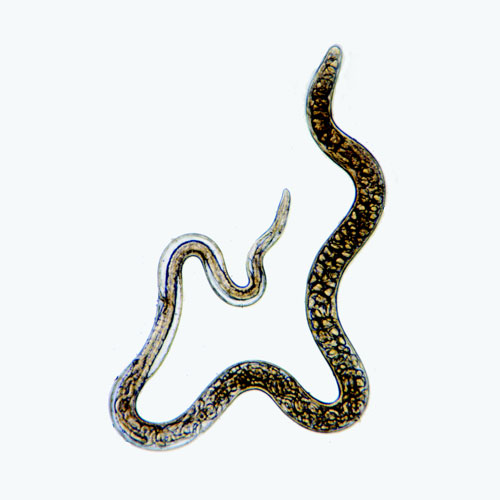 TERRIBLE TRICHINELLA Worms 