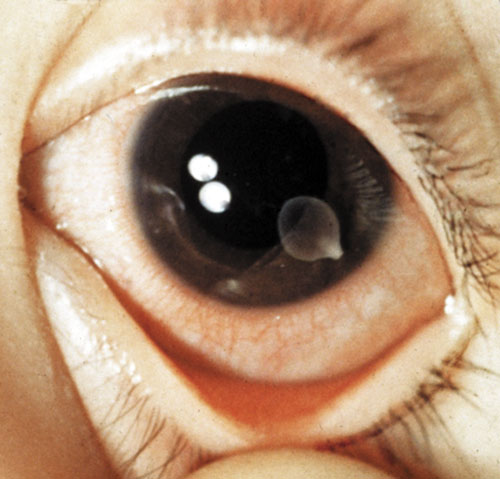 TRICKY TAPEWORM Worms 