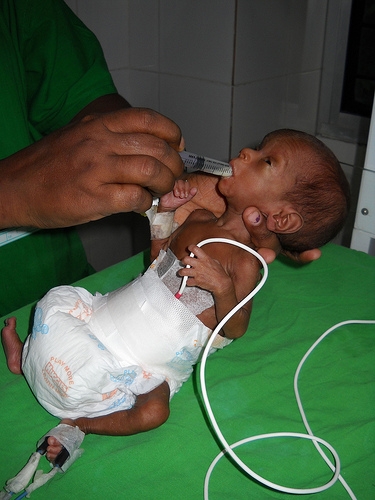 Breast milk is vital for a premature newborn weighing barely 500 grams. Credit: Manipadma Jena/IPS