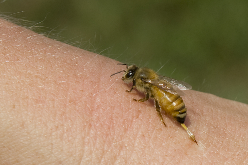 Report: More People Killed By Bees, Drowning In Bath Than From Terrorism bee sting 2